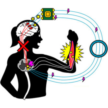 A schematic showing how the neural bridge works