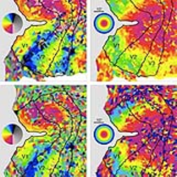 A brain scanner that knows what you are looking at