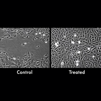 Nanoparticles Heal Wounds 50 Percent Faster