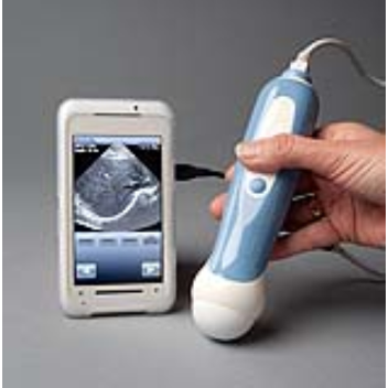 smartphone based ultrasound device