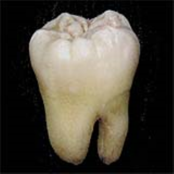 Regenerative gel helps teeth to regrow