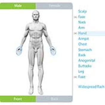 Identify skin conditions in three easy steps