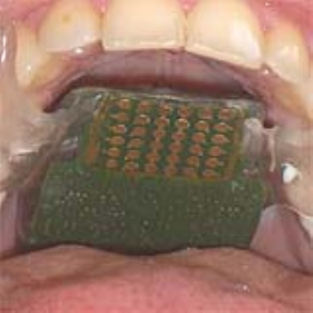 Device that relays a person's body movements to an array of electrodes on their tongue