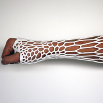 3D printed Cortex Exoskeleton concept could crack plaster casts