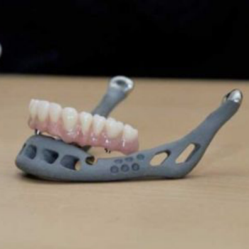 3D Printed Jaw